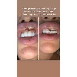 拉眼皮图片,美丽背后的秘密